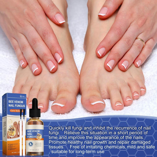 Sérum para Uñas con Veneno de Abeja 50ml – Tratamiento Antihongos y Cuidado Intensivo